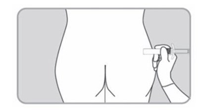 Lanreotide fig 17 - Lanreotide fig 17